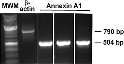 Pro-Resolving Mediator Annexin A1 Regulates Intracellular Ca2+ and Mucin Secretion in Cultured Goblet Cells Suggesting a New Use in Inflammatory Conjunctival Diseases